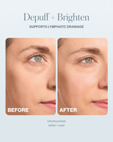 DERMAFLASH COOL - DERMAFLASH COOL