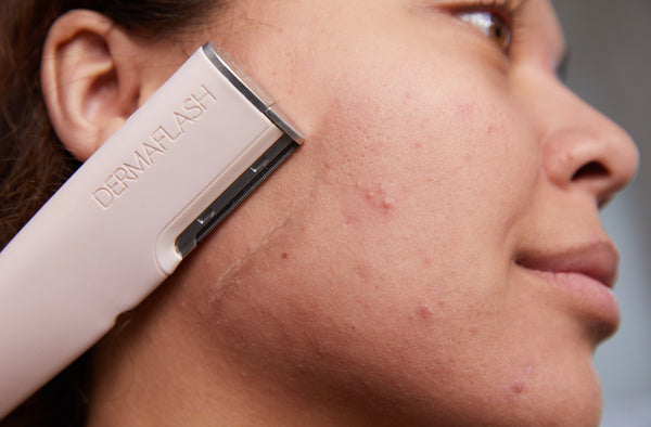 Does Dermaplaning Cause Acne?