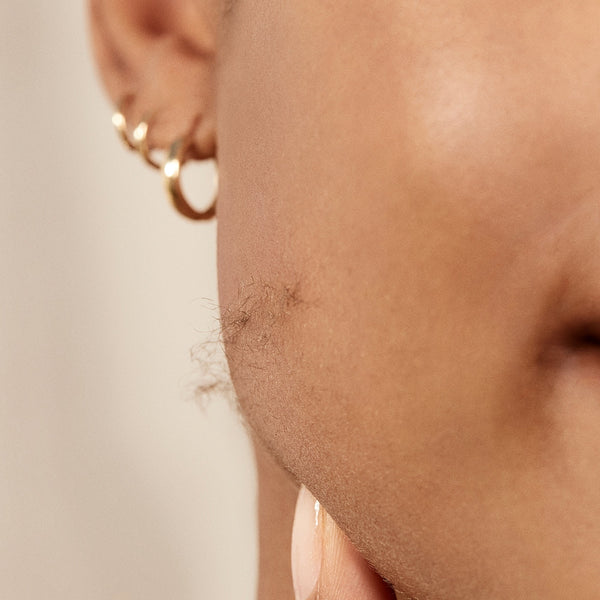 Does Minoxidil Cause Facial Hair Growth? (And How Sonic