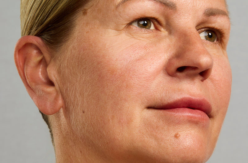 Peach Fuzz & Perimenopause: Your Questions Answered