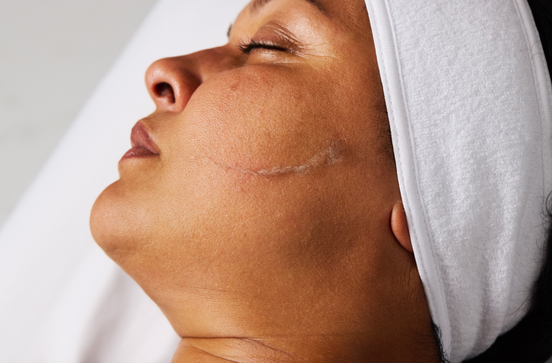 Top 5 Reasons You’re Seeing Flaky Skin (And How to Fix It Fast)