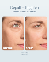 DERMAFLASH COOL - LIMITED EDITION! Platinum | COOL device